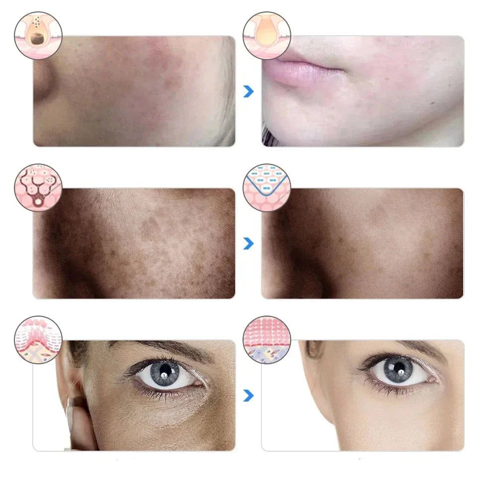 GlowMask - Maschera per terapia a LED con 7 colori per la cura del viso